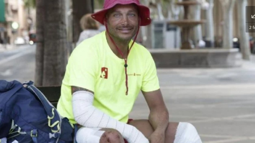 Así terminó Leandro Staltari, con vendajes en brazos, piernas y la cabeza, producto de los choques con las rocas de la cueva donde salvó a los tres niños.