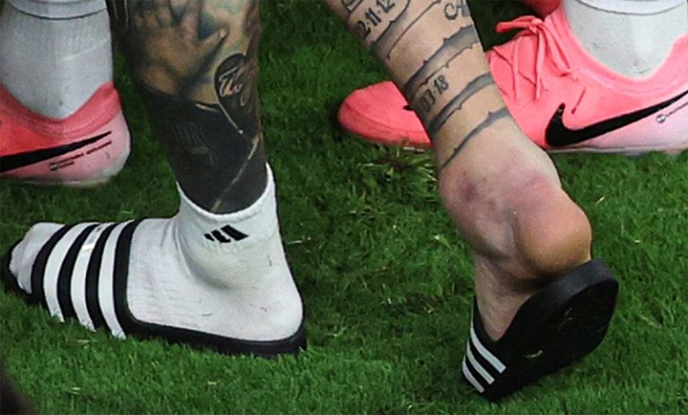 ¿Cuánto tiempo de recuperación tiene Lionel Messi por su lesión?