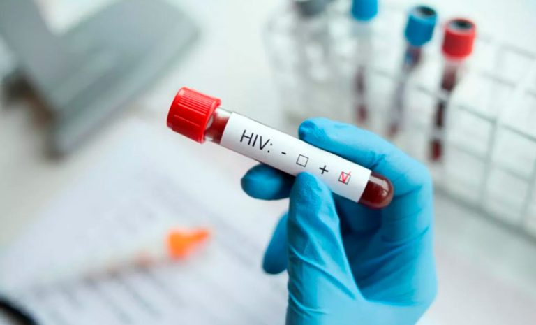 Condenaron a un hombre por contagiar con VIH a su ex pareja