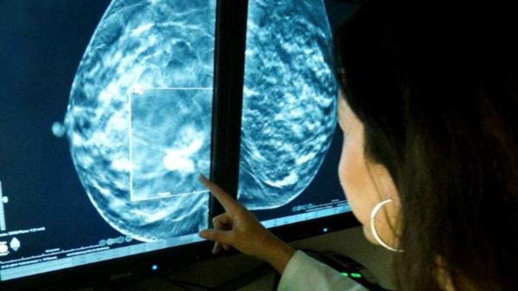 Vicente López, cáncer de mama