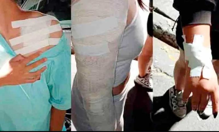 Evacuaron un boliche en Bariloche con varias personas quemadas