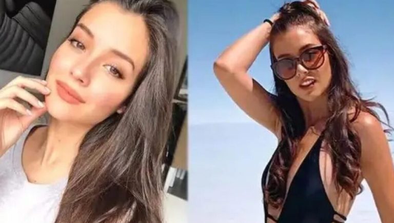 “Ya no me eligen”: la historia de una modelo que busca vencer las secuelas de un ACV y la discriminación